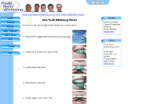 teeth whitening scotland